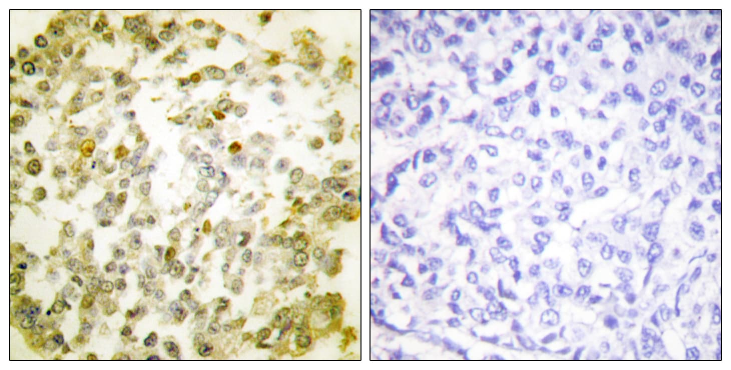 TOP2A / Topoisomerase II Alpha Antibody (aa1081-1130)