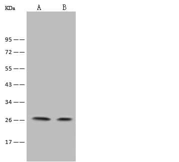 NAA10 / ARD1A Antibody (Preservative Free)