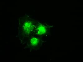 Monoclonal Mouse anti-Human PMEL / SILV / gp100 Antibody (clone OTI9G3, IF, WB)