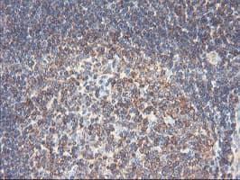PFKP Antibody (clone OTI1F2)