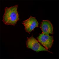 IHC-plus™ NME1 / NM23 Antibody (clone 4B2)