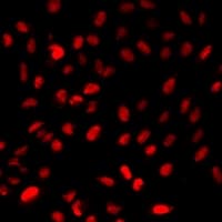 SSX2 Antibody