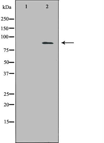 ECE-1 Antibody