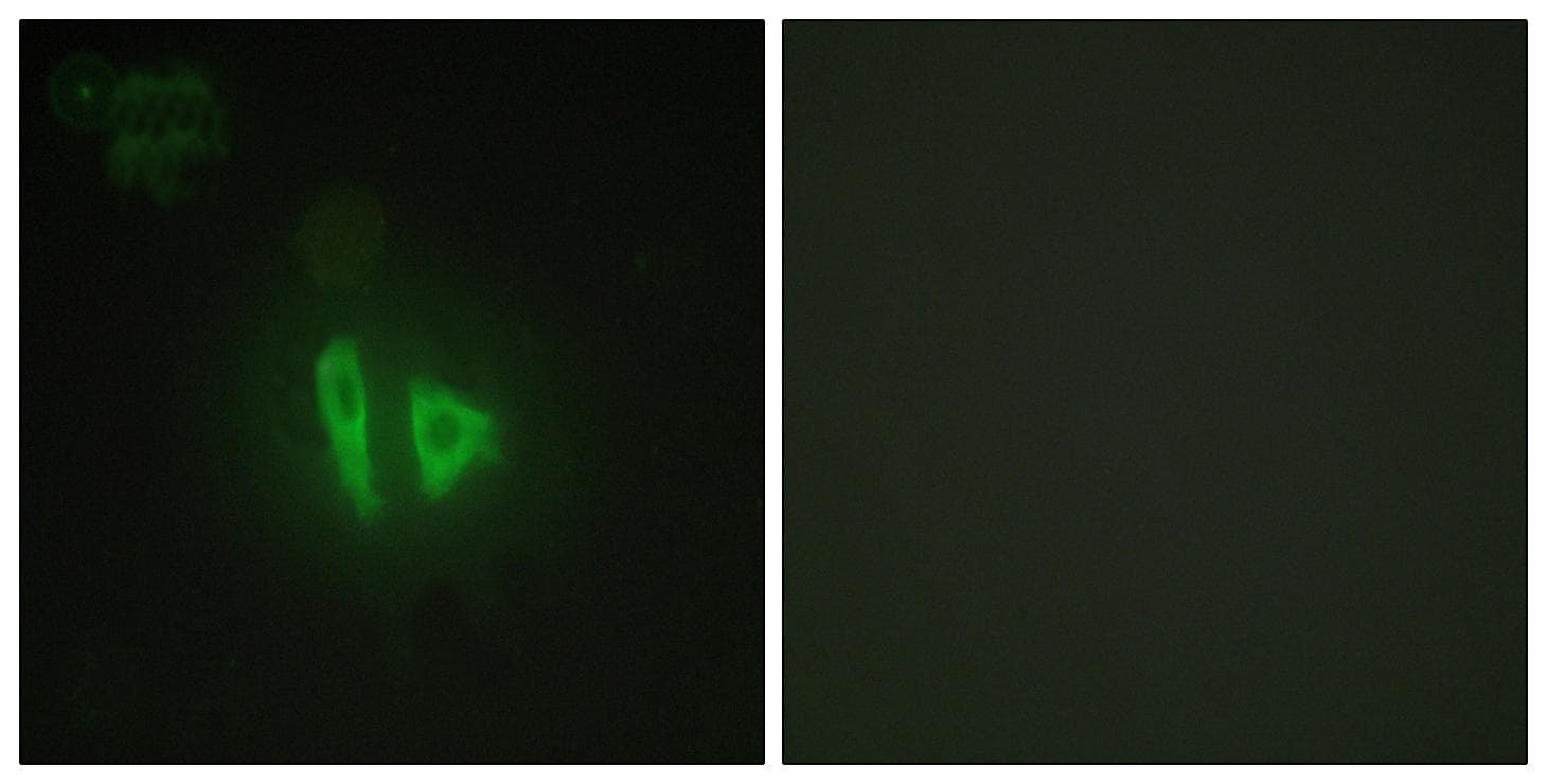 AKAP11 / KIAA0629 Antibody