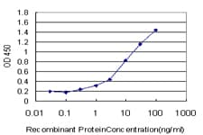 IHC-plus™ Monoclonal Mouse anti-Human STXBP1 / MUNC18-1 Antibody (clone 6D1, IHC, WB)
