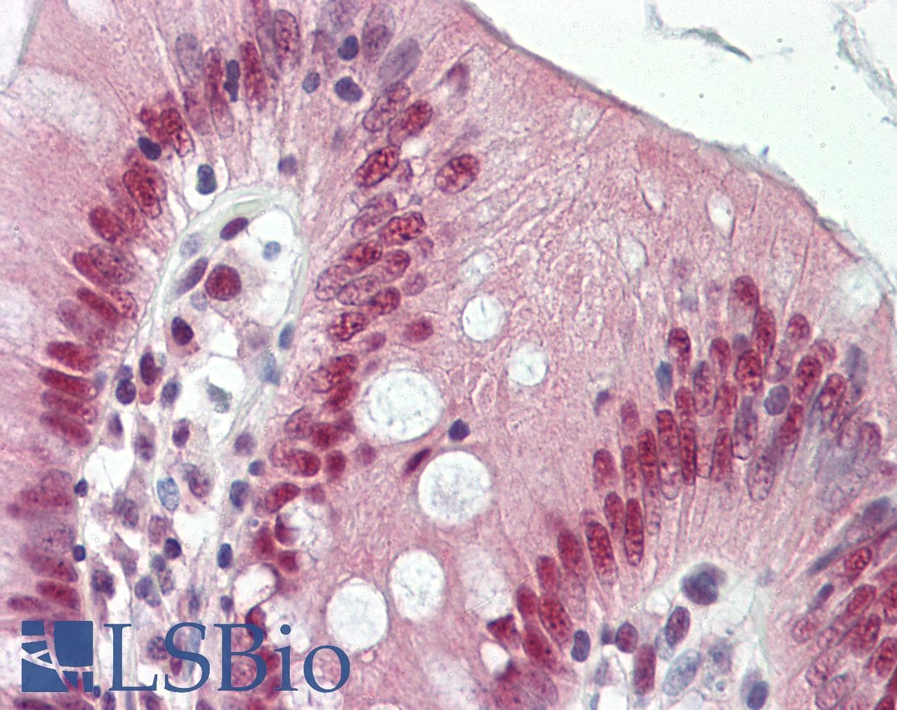 IHC-plus™ AKAP8 / AKAP95 Antibody (aa331-380)