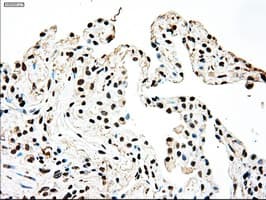 SSB / La Antibody (clone OTI2C8)
