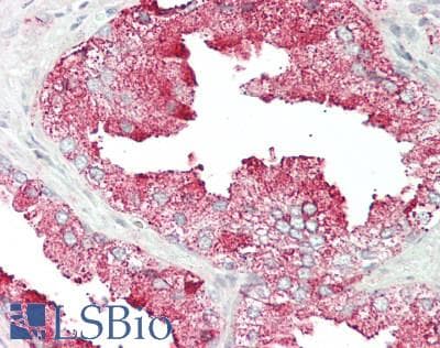 IHC-plus™ Polyclonal Rabbit anti-Human PDZD3 Antibody (aa119-435, IHC, WB)