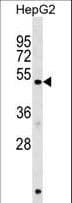 HERPUD1 / HERP Antibody (aa55-83)