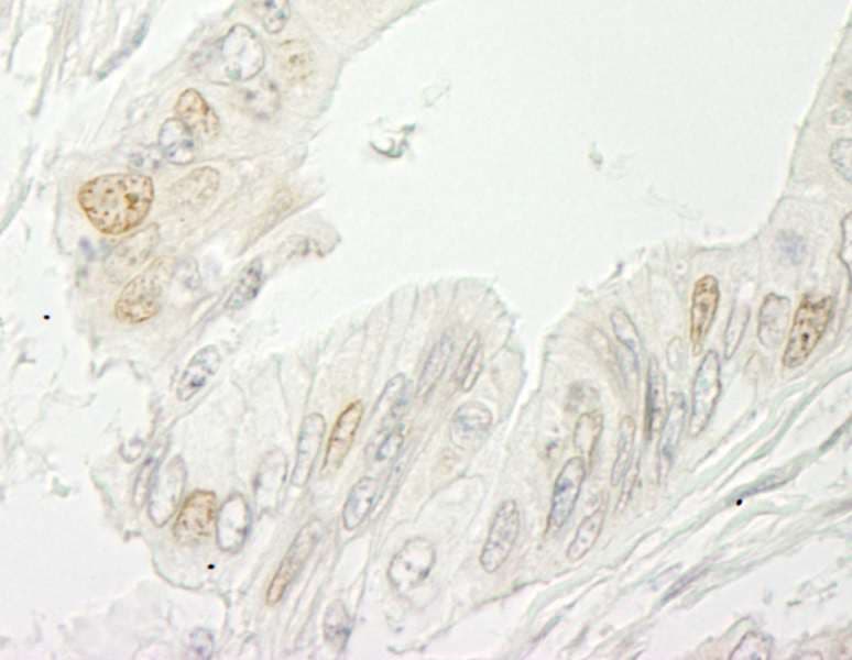 Polyclonal Rabbit anti-Human RBM10 Antibody (aa880-C-term, IHC)