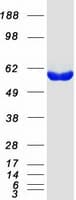 Human GPT2 / ALT2 Protein (Recombinant Myc-DDK (Flag))