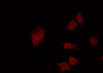 FAK / Focal Adhesion Kinase Antibody (phospho-Ser843)