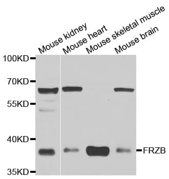 SFRP-3 / FRZB Antibody