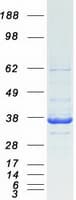 Human CAPZA1 / CAPZ Alpha 1 Protein (Recombinant Myc-DDK (Flag))