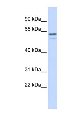 TRIM6 Antibody (aa144-193)