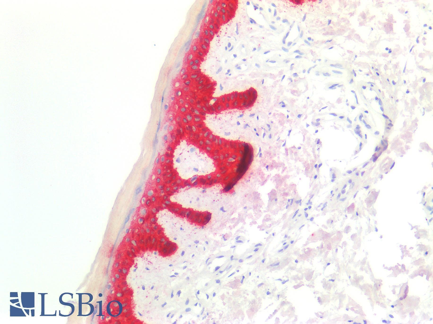 PathPlus™ KRT17 / CK17 / Cytokeratin 17 Antibody