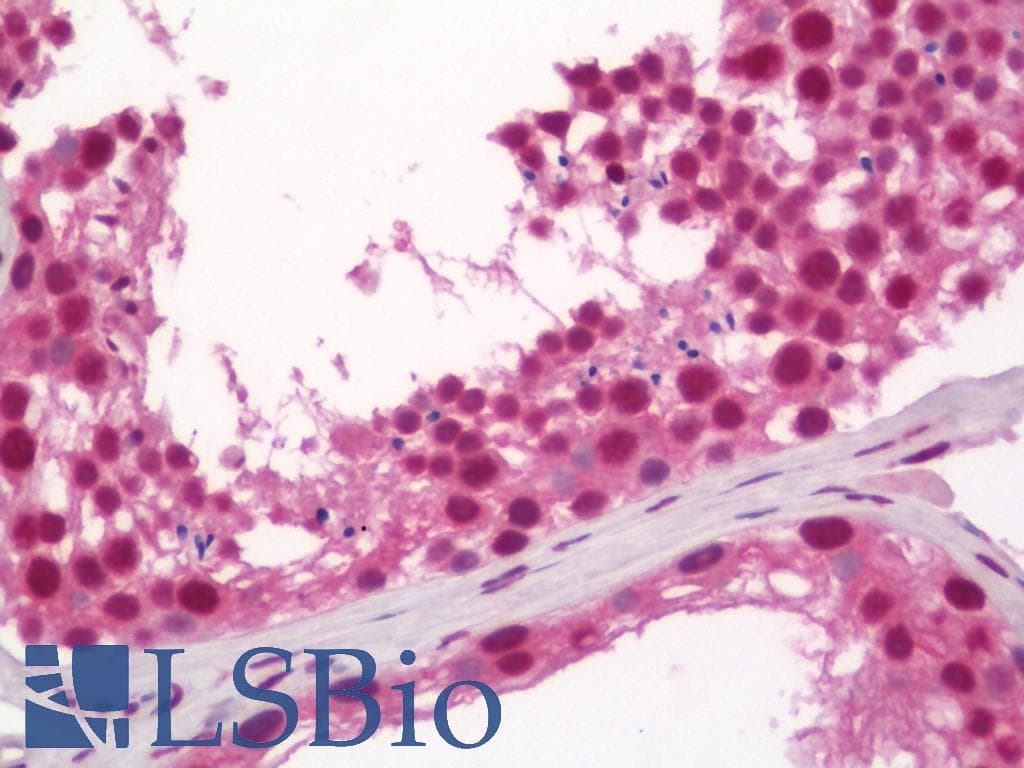 IHC-plus™ Monoclonal Mouse anti-Human NHLH1 / HEN1 Antibody (clone 4D7, IHC)