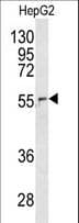 NUP62 Antibody (aa492-520)