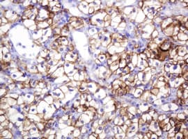 CA12 / Carbonic Anhydrase XII Antibody (clone OTI1A6)