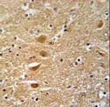 KIF3C Antibody (aa713-741)