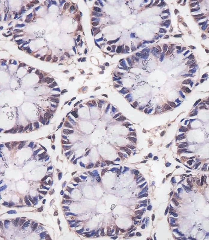 MBD2 Antibody (clone 1812CT625.9.45)