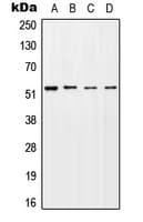 Polyclonal Rabbit anti-Human STK11 / LKB1 Antibody (phospho-Ser428, WB)