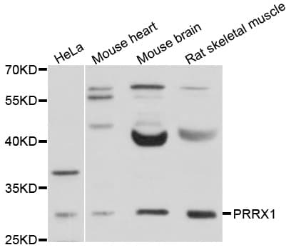 Polyclonal Rabbit anti-Human PRX-1 / PRRX1 Antibody (WB)
