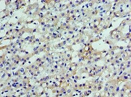 SHFM3 / FBXW4 Antibody (aa143-412)