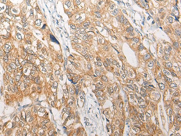Polyclonal Rabbit anti-Human RGN / Regucalcin Antibody (IHC, WB)
