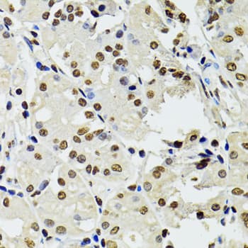 CDX2 Antibody