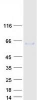 Human Fibulin-3 / EFEMP1 Protein (Recombinant Myc-DDK (Flag))