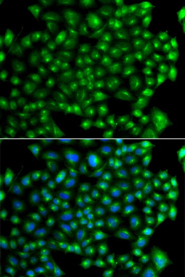 IHC-plus™ ZFYVE1 / DFCP1 Antibody