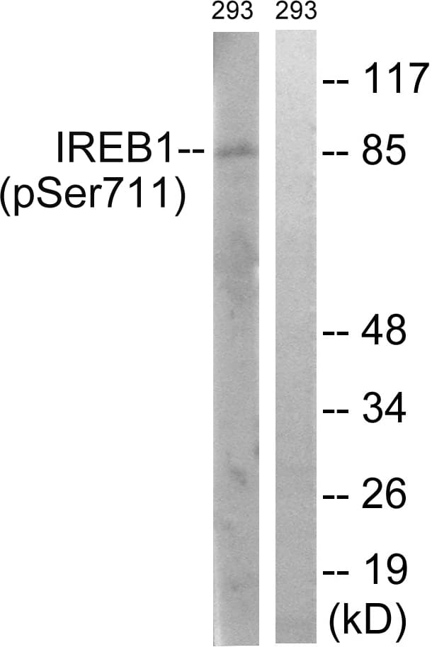 Polyclonal Rabbit anti-Human ACO1 / Aconitase Antibody (phospho-Ser711, IHC, WB)
