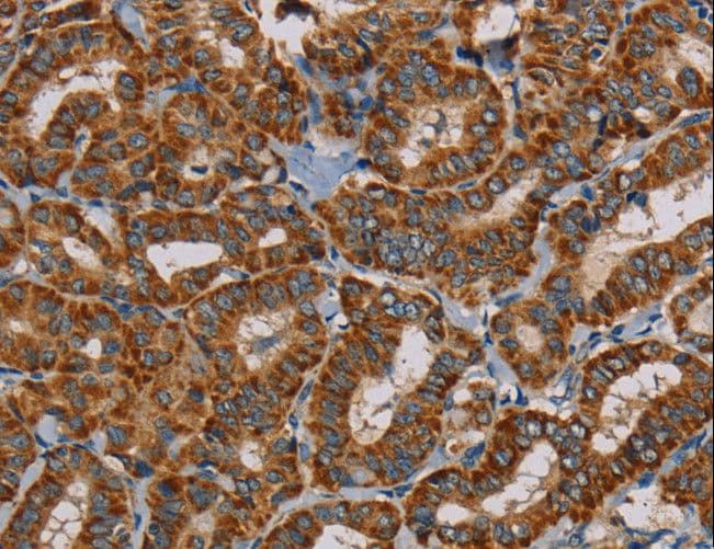 MRPL28 Antibody