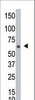 NEK8 Antibody (aa573-604)