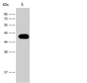 THPO / TPO / Thrombopoietin Antibody