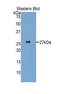 RBP3 / IRBP Antibody (aa1027-1229)