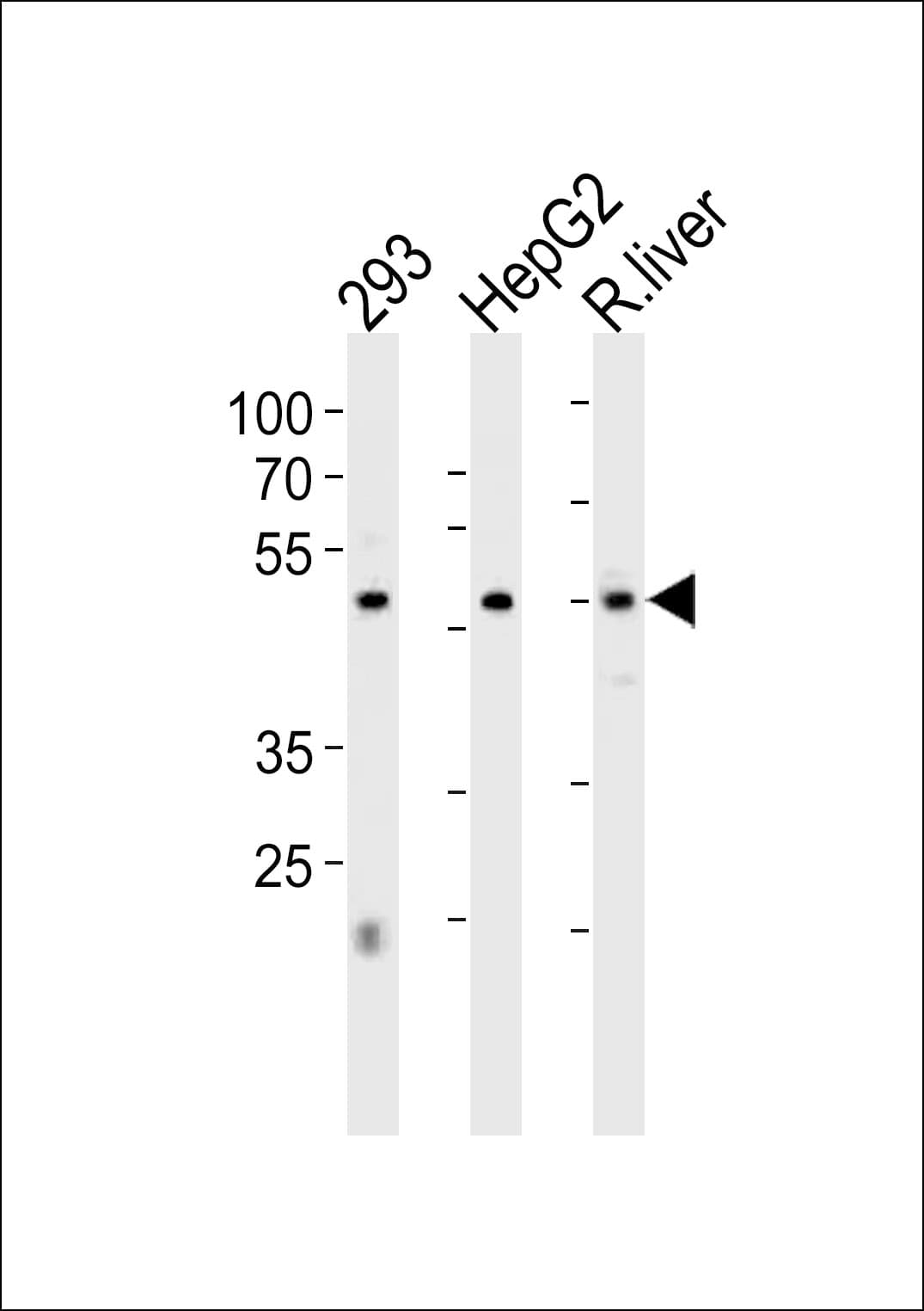 HNF4A / HNF4 Antibody (aa281-312)