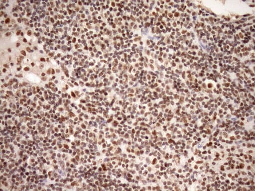 SYF2 / p29 Antibody (aa2-92, clone OTI6A5, Carrier-free)