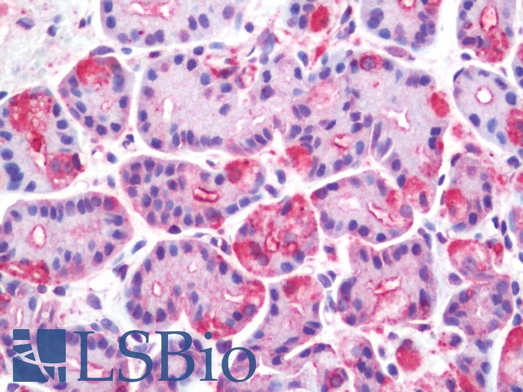PathPlus™ Polyclonal Rabbit anti-Human WNT10A Antibody (Internal, IHC)
