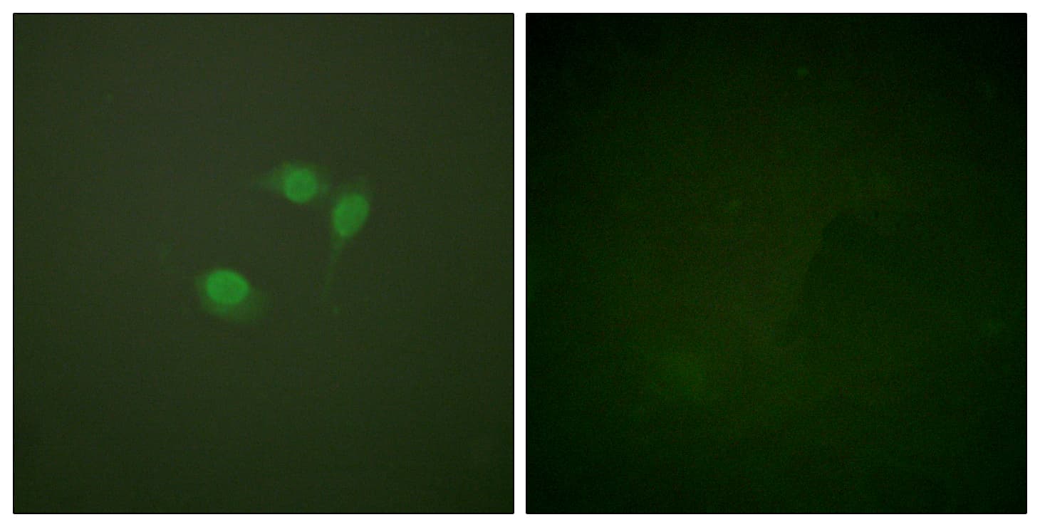 IHC-plus™ Polyclonal Rabbit anti-Human SUMO1 / SMT3 Antibody (aa1-50, IHC, IF, WB)