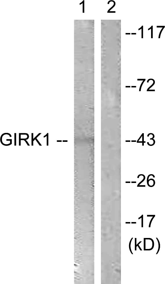 KCNJ3 / GIRK1 Antibody (aa151-200)