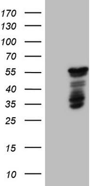 Monoclonal Mouse anti-Human BHLHE41 / BHLHB3 / SHARP1 Antibody (clone OTI8H5, aa1-297, IHC, WB)