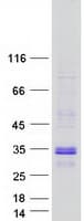 Human LMO2 Protein (Recombinant Myc-DDK (Flag))