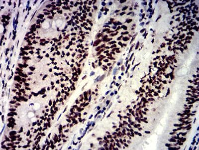 HNRPM / HNRNPM Antibody (clone 5G6C11)