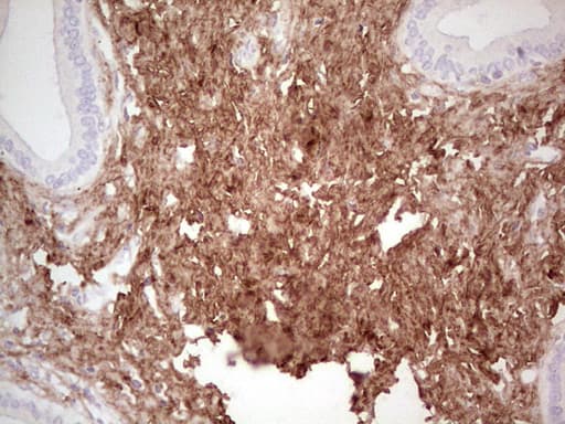 CSNK1G1 / CKI-Gamma 1 Antibody (aa163-422, clone OTI4D9)