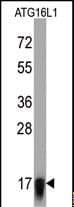 Monoclonal Mouse anti-Human ATG16L1 / ATG16L Antibody (clone 54CT27.2.6, IHC, WB)