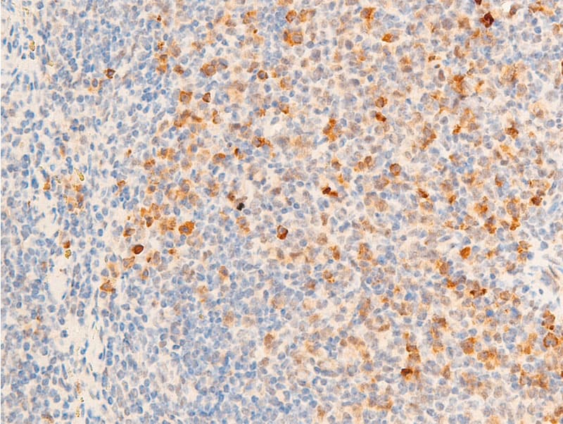 Polyclonal Rabbit anti-Human TK1 / TK / Thymidine Kinase Antibody (phospho-Ser13, IHC, IF, WB)