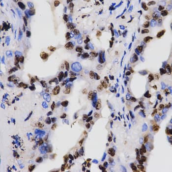 Polyclonal Rabbit anti-Human Histone H3 Antibody (Di-Methyl-Lys4, IHC, IF, WB)