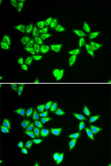 PTRH2 / BIT1 Antibody